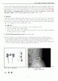 척추관 협착증 Spinal stenosis -A+받은 자료입니다. 9페이지