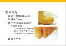 발 관리 : 발의 구조와 기능 & 발관리의 실제 29페이지
