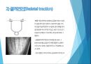 견인 간호(피부견인, 골격견인, 간호과정) 15페이지