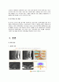 척추관협착증(연구의 필요성 부터~간호진단 및 참고문헌) 3페이지