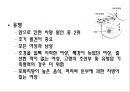 암 13페이지