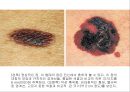 암 19페이지