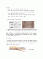 급성충수염(ACUTE APPENDICITIS)케이스 7페이지