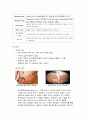 급성충수염(ACUTE APPENDICITIS)케이스 8페이지