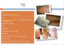 jaundice, 황달과지방간, 소양증, 피로, 영양부족, 출혈위험성, 황달정의, 황달증상, 황달치료, 황달간호, 지방간원인, 지방간병태생리, 지방간치료, 간과영양 9페이지