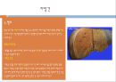 jaundice, 황달과지방간, 소양증, 피로, 영양부족, 출혈위험성, 황달정의, 황달증상, 황달치료, 황달간호, 지방간원인, 지방간병태생리, 지방간치료, 간과영양 13페이지