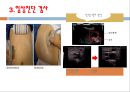간,담도 및 췌장의 건강문제과 간호, 간의구조, 간의기능, 담도의구조, 담도의기능, 췌장의구조, 췌장의기능, 건강사정, 신체검진, 임상진단검사, 35페이지