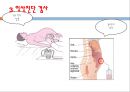간,담도 및 췌장의 건강문제과 간호, 간의구조, 간의기능, 담도의구조, 담도의기능, 췌장의구조, 췌장의기능, 건강사정, 신체검진, 임상진단검사, 42페이지