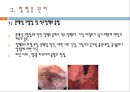 간경변, 간경변치료, 간경변간호, 간경변약물치료, 간경변식이관리, 간경변합병증관리, 문맥성고혈압, 식도정맥류출혈, 복수, 간성뇌병증 5페이지