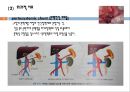 간경변, 간경변치료, 간경변간호, 간경변약물치료, 간경변식이관리, 간경변합병증관리, 문맥성고혈압, 식도정맥류출혈, 복수, 간성뇌병증 12페이지