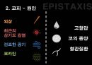 응급간호학 코피 epistaxis 비골 골절 nasal bone fracture 발표 자료 6페이지