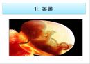 조기양막파열 케이스 PPT (연구의 필요성부터 ~ 문헌고찰,간호과정, 간호사정, 간호진단, 느낀점 ) A+++++ 6페이지