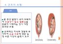 태반조기박리 PPT (사례 및 사정을 바탕으로 개념,분류,증상,진단,치료,간호지침) A+++++ 12페이지