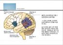 인지신경심리학_언어의 산출과 이해 및 언어장애 11페이지