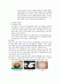 [간호] 간경변증(간경화증) 31페이지