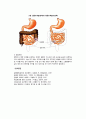 [염증성장질환] 만성염증성장질환(만성궤양성대장염, 크론병)의 원인과 증상 및 치료방법 - 영양치료, 약물치료, 수술치료(결장조루술, 회장조루술) 5페이지