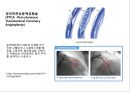 심혈관 질환 간호, ECG 18페이지