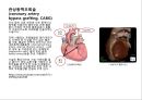 심혈관 질환 간호, ECG 19페이지