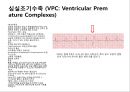 심혈관 질환 간호, ECG 36페이지