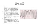 심혈관 질환 간호, ECG 38페이지