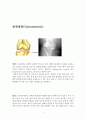 퇴행성관절염 Osteoarthritis 레포트 3페이지