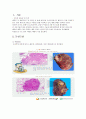 폐암 케이스(문헌고찰,병태생리,간호과정,간호사정,간호진단 포함) A+++++ 2페이지