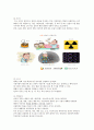 폐암 케이스(문헌고찰,병태생리,간호과정,간호사정,간호진단 포함) A+++++ 3페이지