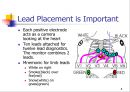 MI환자의 마취 관리 8페이지