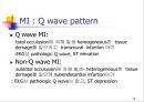 MI환자의 마취 관리 13페이지