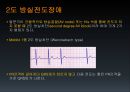EKG 10페이지