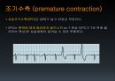 EKG 21페이지