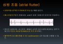 EKG 26페이지