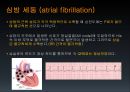 EKG 31페이지