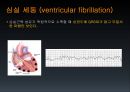 EKG 32페이지