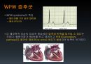 EKG 34페이지
