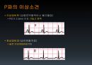 EKG 37페이지