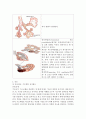 폐기종(pulmonary emphysema) 간호 4페이지