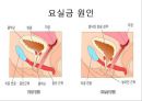 환경위생 - 폐렴, 인플루엔자,개인위생 - 요실금,식품위생 - 노로 바이러스 13페이지