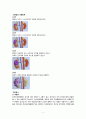 케이스스터디, 신장암 사례연구, 성인간호학 사례연구 5페이지