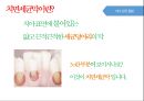 청소년기 구강관리 보건교육 ppt 파일 (구강보건교육, 치아관리, 치과) 10페이지
