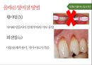 청소년기 구강관리 보건교육 ppt 파일 (구강보건교육, 치아관리, 치과) 26페이지