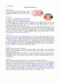 cerebral infarction 9페이지