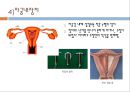 피임,  성생활, 피임의조건, 피임방법, 가족계획법, 차단법, 호르몬방법, 자궁내장치, 불임술 10페이지