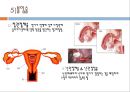 피임,  성생활, 피임의조건, 피임방법, 가족계획법, 차단법, 호르몬방법, 자궁내장치, 불임술 11페이지