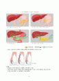 성인간호) 췌장암 환자의 치료와 간호 3페이지
