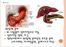 급성 췌장염 case ppt자료 4페이지