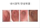 상부소화관 내시경 소견 12페이지