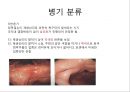 상부소화관 내시경 소견 17페이지