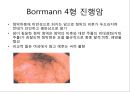 상부소화관 내시경 소견 34페이지