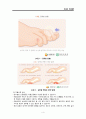 당뇨 DM FOOT CASE STUDY (당뇨병성 발 궤양) A+ 5페이지